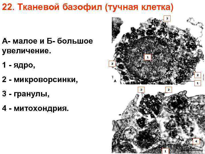 22. Тканевой базофил (тучная клетка) 3 А- малое и Б- большое увеличение. 1 1