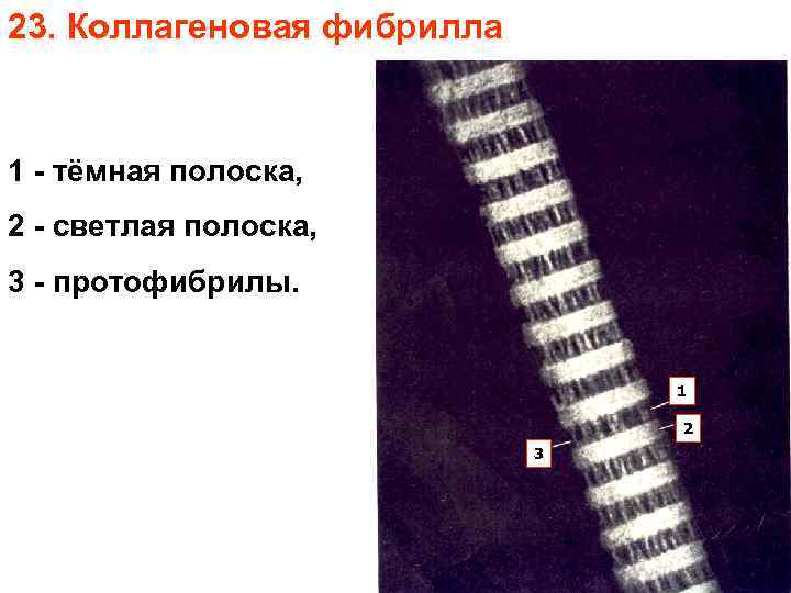 23. Коллагеновая фибрилла 1 - тёмная полоска, 2 - светлая полоска, 3 - протофибрилы.