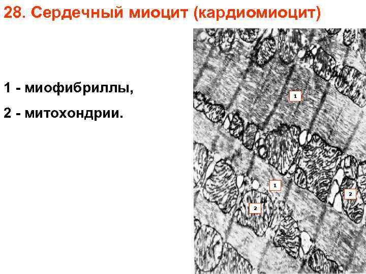 28. Сердечный миоцит (кардиомиоцит) 1 - миофибриллы, 1 2 - митохондрии. 1 2 2