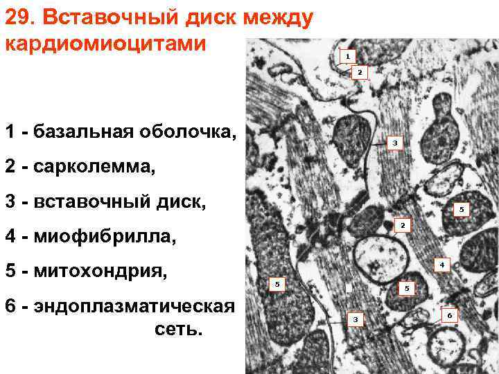 Схема вставочного диска - 89 фото