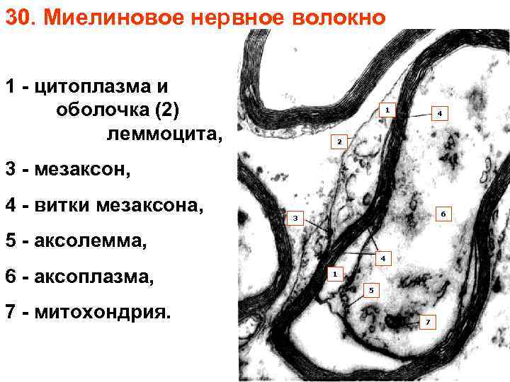 30. Миелиновое нервное волокно 1 - цитоплазма и оболочка (2) леммоцита, 1 4 2