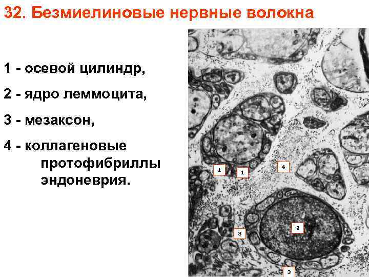 32. Безмиелиновые нервные волокна 1 - осевой цилиндр, 2 - ядро леммоцита, 3 -