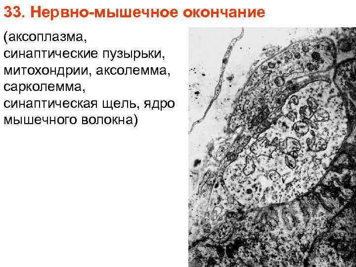 33. Нервно-мышечное окончание (аксоплазма, синаптические пузырьки, митохондрии, аксолемма, сарколемма, синаптическая щель, ядро мышечного волокна)