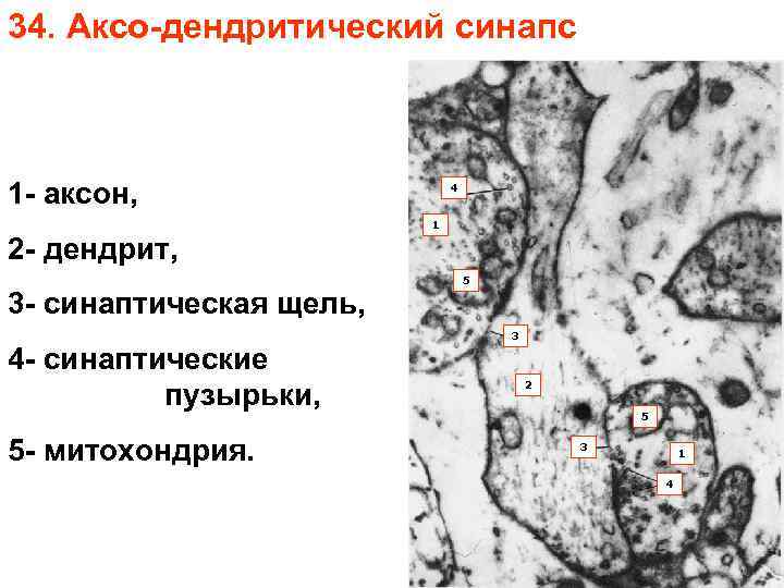 34. Аксо-дендритический синапс 1 - аксон, 4 1 2 - дендрит, 3 - синаптическая