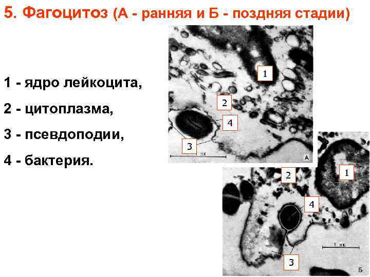 5. Фагоцитоз (А - ранняя и Б - поздняя стадии) 1 1 - ядро