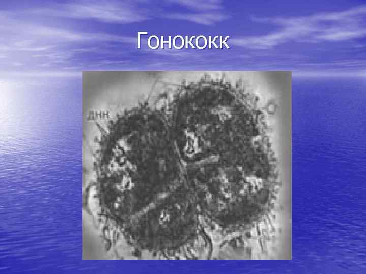 Гонококк 