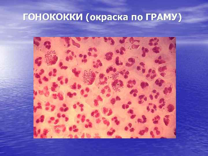 ГОНОКОККИ (окраска по ГРАМУ) 