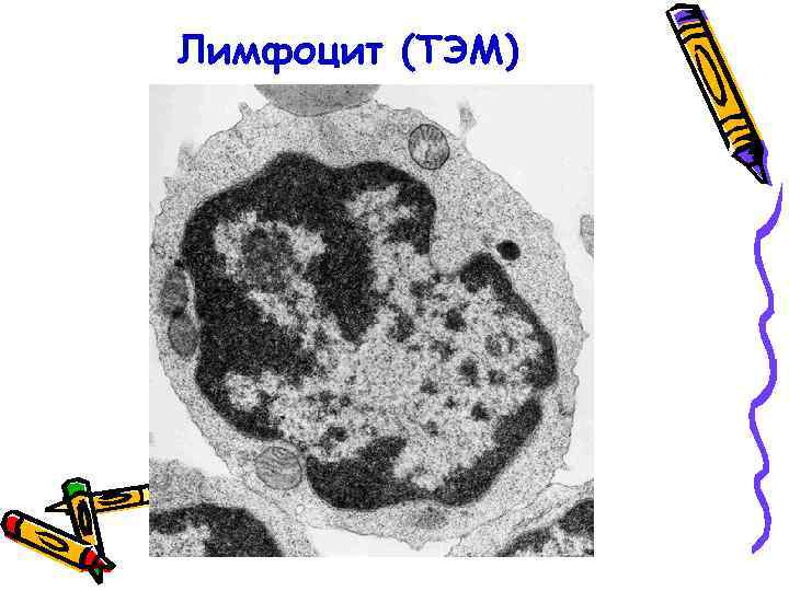 Лимфоцит (ТЭМ) 