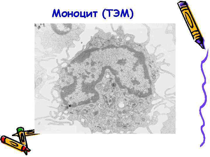 Моноцит (ТЭМ) 