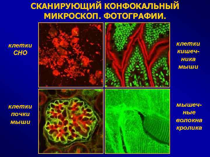 СКАНИРУЮЩИЙ КОНФОКАЛЬНЫЙ МИКРОСКОП. ФОТОГРАФИИ. клетки CHO клетки кишечника мыши клетки почки мышечные волокна кролика