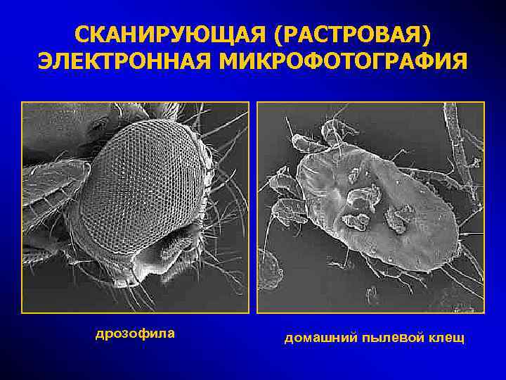 СКАНИРУЮЩАЯ (РАСТРОВАЯ) ЭЛЕКТРОННАЯ МИКРОФОТОГРАФИЯ дрозофила домашний пылевой клещ 