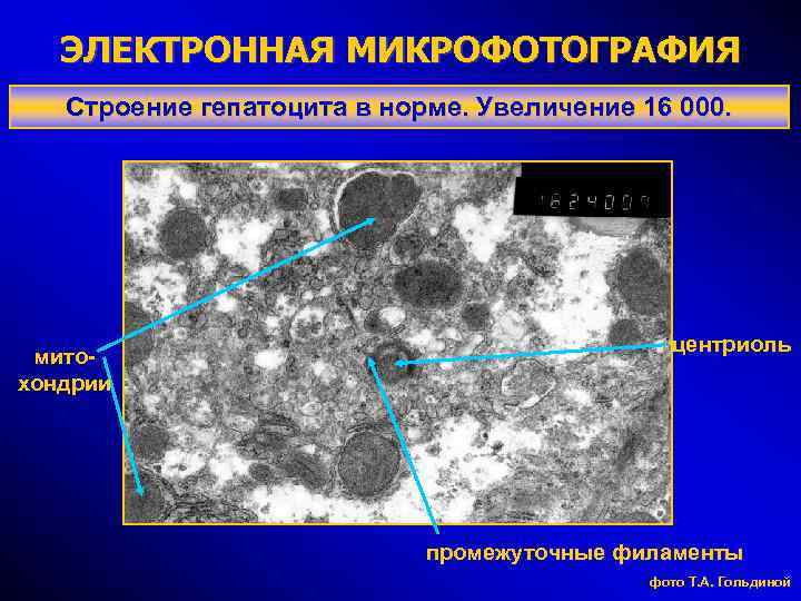 ЭЛЕКТРОННАЯ МИКРОФОТОГРАФИЯ Строение гепатоцита в норме. Увеличение 16 000. митохондрии центриоль промежуточные филаменты фото