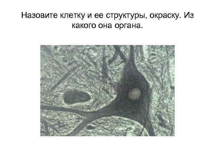 Назовите клетку и ее структуры, окраску. Из какого она органа. 