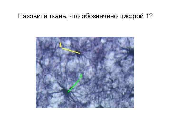 Назовите ткань, что обозначено цифрой 1? 