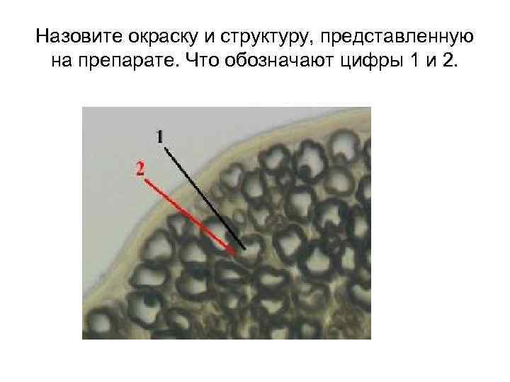 Назовите окраску и структуру, представленную на препарате. Что обозначают цифры 1 и 2. 