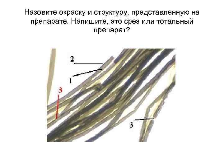 Назовите окраску и структуру, представленную на препарате. Напишите, это срез или тотальный препарат? 