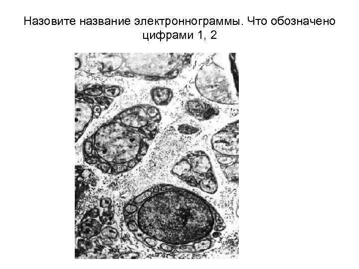 Назовите название электроннограммы. Что обозначено цифрами 1, 2 