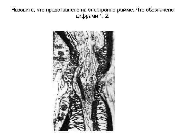 Назовите, что представлено на электроннограмме. Что обозначено цифрами 1, 2. 