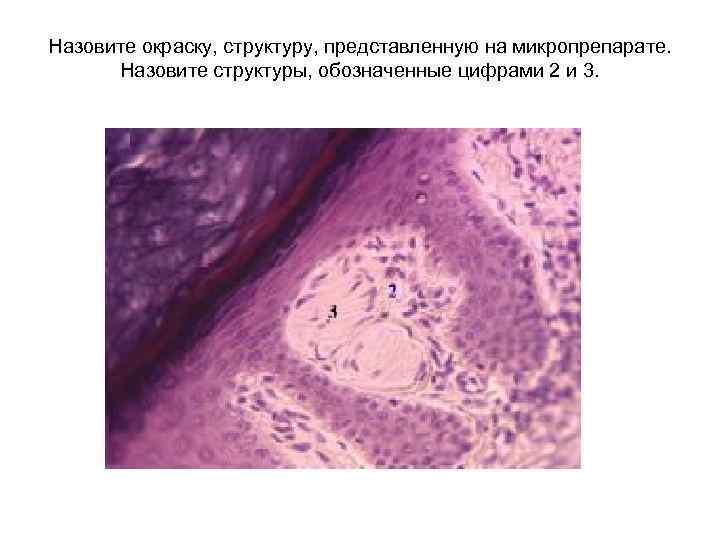 Назовите окраску, структуру, представленную на микропрепарате. Назовите структуры, обозначенные цифрами 2 и 3. 