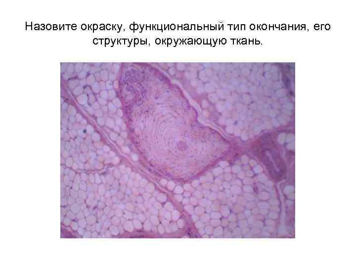 Назовите окраску, функциональный тип окончания, его структуры, окружающую ткань. 