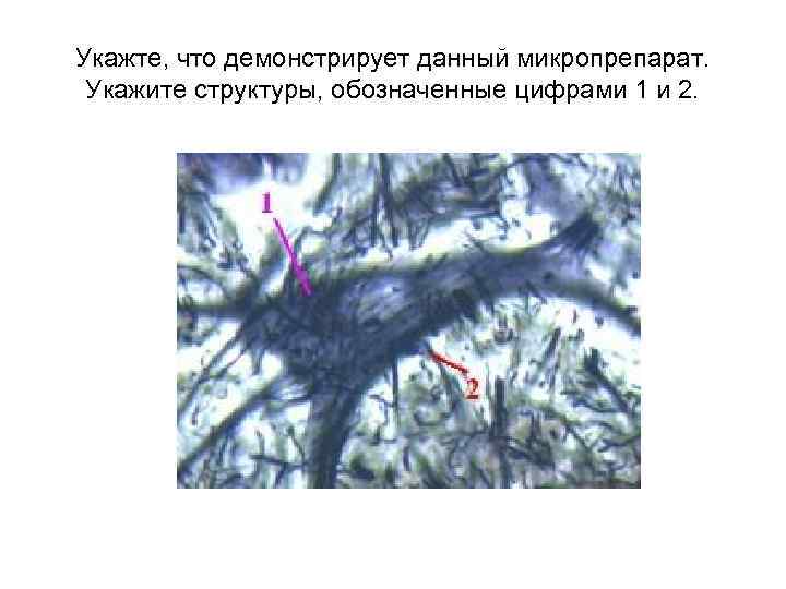 Укажте, что демонстрирует данный микропрепарат. Укажите структуры, обозначенные цифрами 1 и 2. 