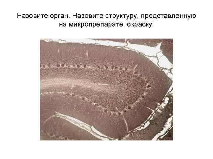 Назовите орган. Назовите структуру, представленную на микропрепарате, окраску. 
