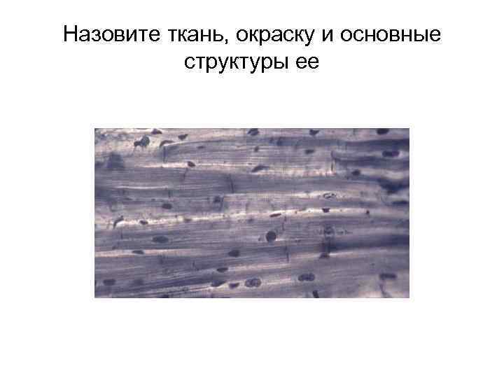 Назовите ткань, окраску и основные структуры ее 
