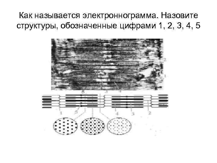 Как называется электроннограмма. Назовите структуры, обозначенные цифрами 1, 2, 3, 4, 5 