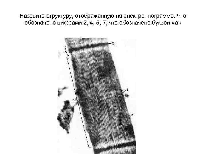 Назовите структуру, отображанную на электроннограмме. Что обозначено цифрами 2, 4, 5, 7, что обозначено