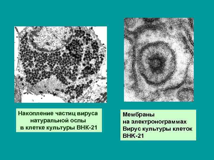 Накопление частиц вируса натуральной оспы в клетке культуры ВНК-21 Мембраны на электронограммах Вирус культуры