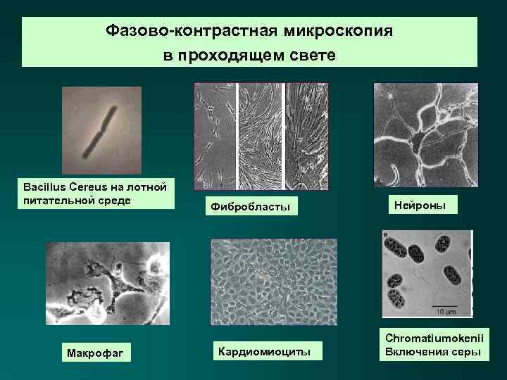 Фазово-контрастная микроскопия в проходящем свете Bacillus Cereus на лотной питательной среде Макрофаг Фибробласты Кардиомиоциты
