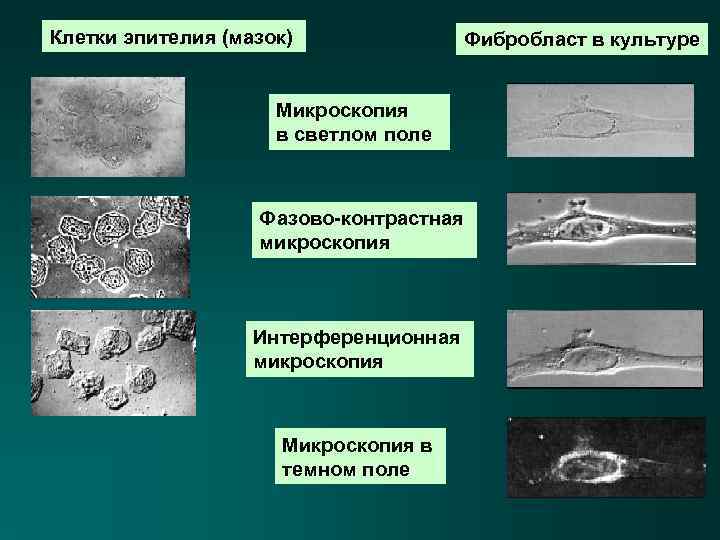 Клетки эпителия (мазок) Фибробласт в культуре Микроскопия в светлом поле Фазово-контрастная микроскопия Интерференционная микроскопия