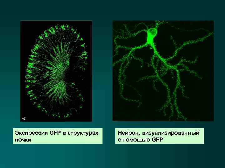 Экспрессия GFP в структурах почки Нейрон, визуализированный с помощью GFP 