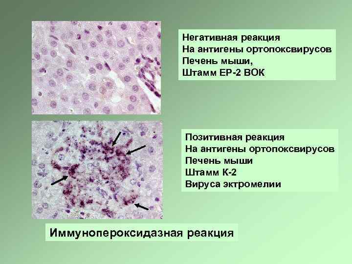 Негативная реакция На антигены ортопоксвирусов Печень мыши, Штамм ЕР-2 ВОК Позитивная реакция На антигены