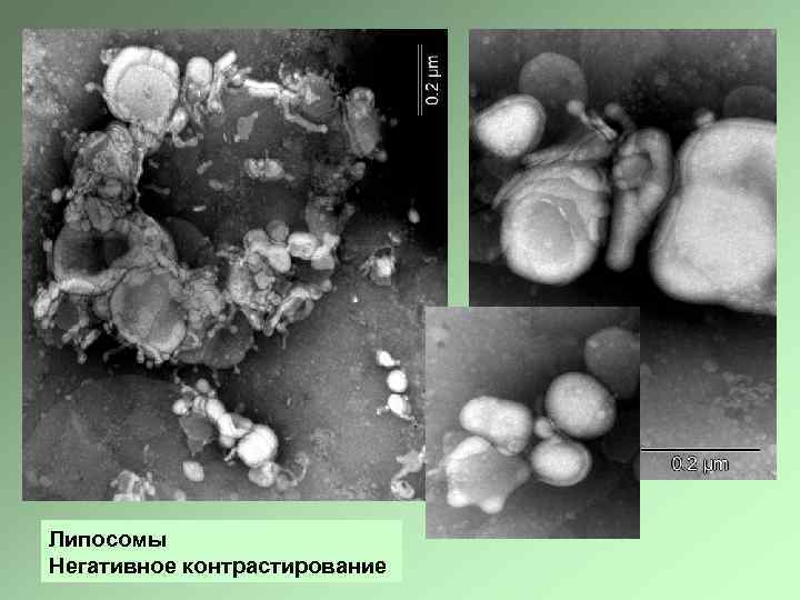 Липосомы Негативное контрастирование 