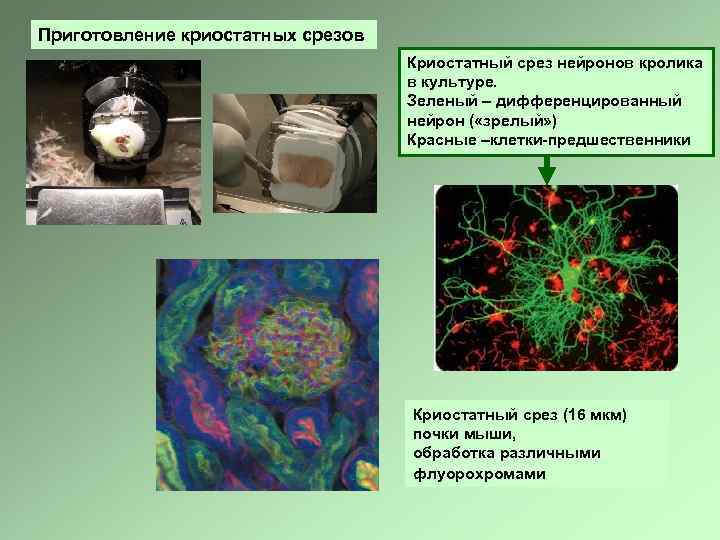 Приготовление криостатных срезов Криостатный срез нейронов кролика в культуре. Зеленый – дифференцированный нейрон (