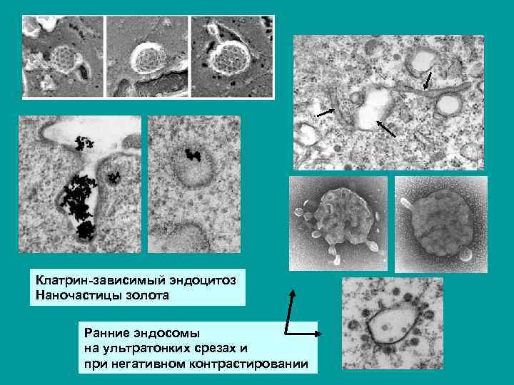 Клатрин-зависимый эндоцитоз Наночастицы золота Ранние эндосомы на ультратонких срезах и при негативном контрастировании 