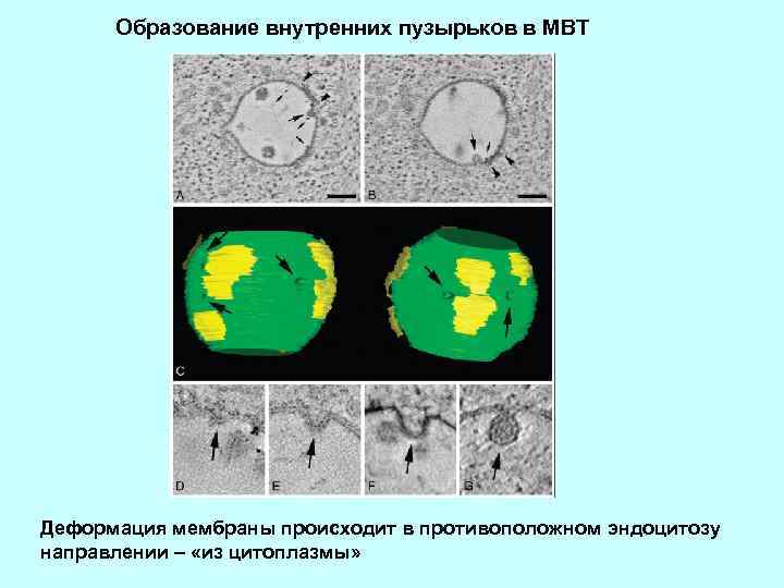 Образование внутренних пузырьков в МВТ Деформация мембраны происходит в противоположном эндоцитозу направлении – «из