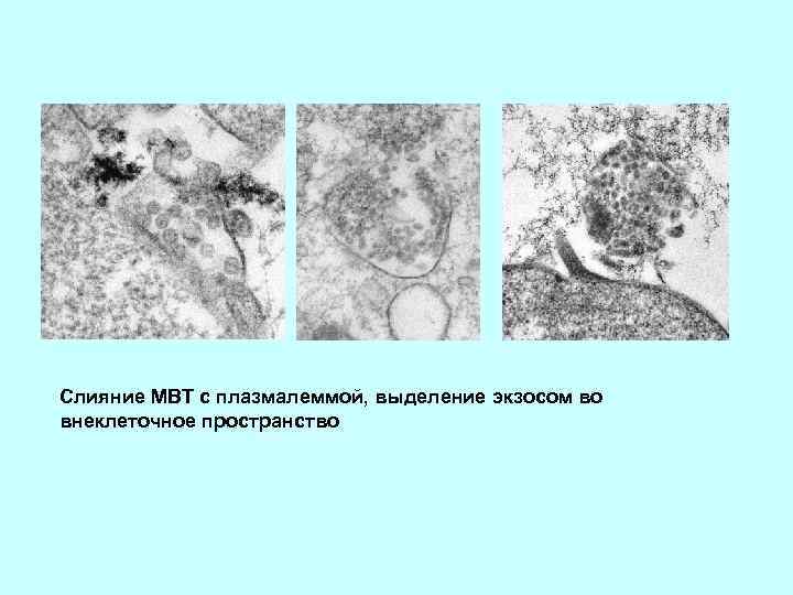 Слияние МВТ с плазмалеммой, выделение экзосом во внеклеточное пространство 