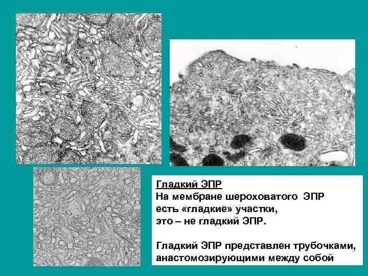 Гладкий ЭПР На мембране шероховатого ЭПР есть «гладкие» участки, это – не гладкий ЭПР.