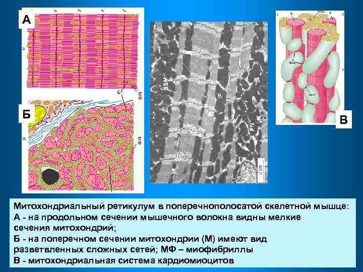 А Б В Митохондриальный ретикулум в поперечнополосатой скелетной мышце: А - на продольном сечении