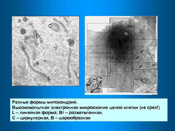 Разные формы митохондрий. Высоковольтная электронная микроскопия целой клетки (не срез!) L – линейная форма;
