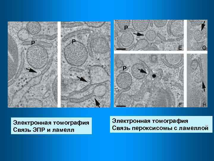 Р Р Электронная томография Связь ЭПР и ламелл Электронная томография Связь пероксисомы с ламеллой