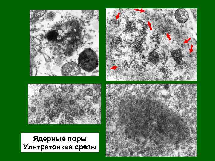 Ядерные поры. Ядерные поры под микроскопом. Ядерная пора. Ядерные поры фото. Ядерные поры снимок.