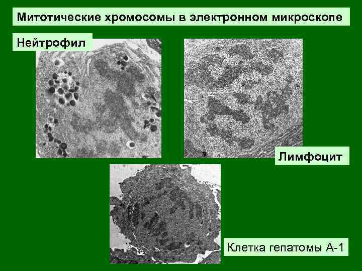 Митотические хромосомы в электронном микроскопе Нейтрофил Лимфоцит Клетка гепатомы А-1 