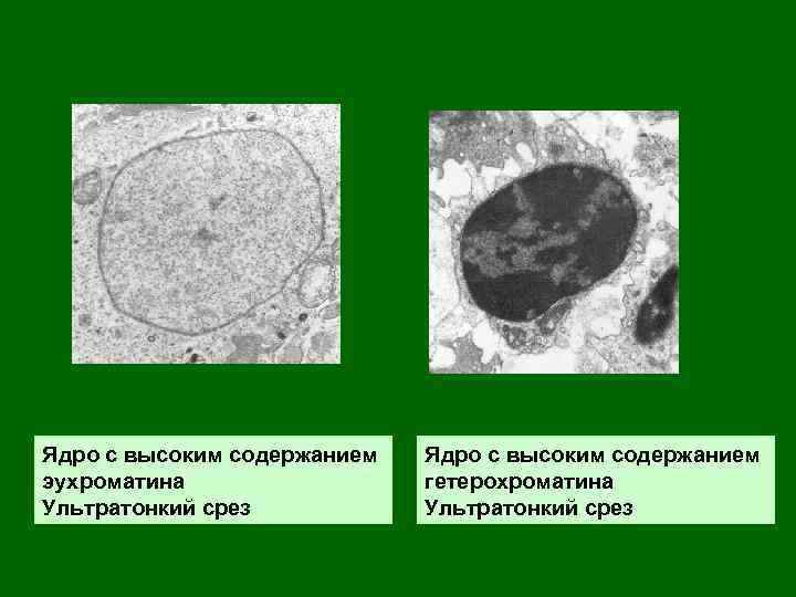 Ядро с высоким содержанием эухроматина Ультратонкий срез Ядро с высоким содержанием гетерохроматина Ультратонкий срез