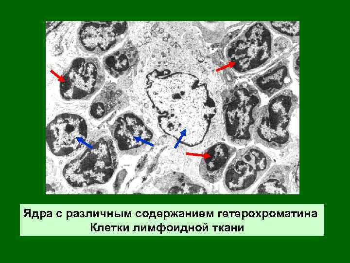 Ядра с различным содержанием гетерохроматина Клетки лимфоидной ткани 