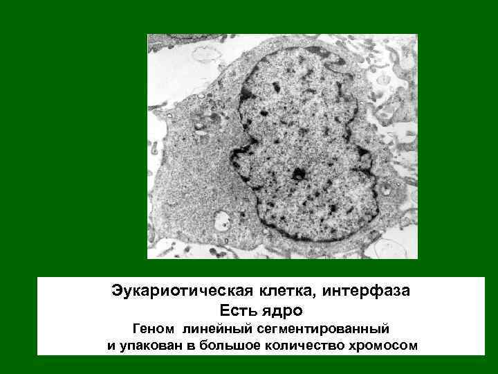 Эукариотическая клетка, интерфаза Есть ядро Геном линейный сегментированный и упакован в большое количество хромосом