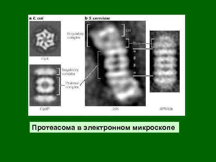 Протеасома в электронном микроскопе 