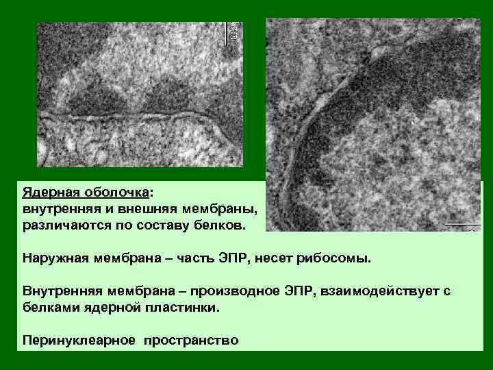 Растворение ядерной мембраны. Наружная мембрана ядерной оболочки. Наружная и внутренняя оболочка мембраны. Перинуклеарное пространство строение и функции.